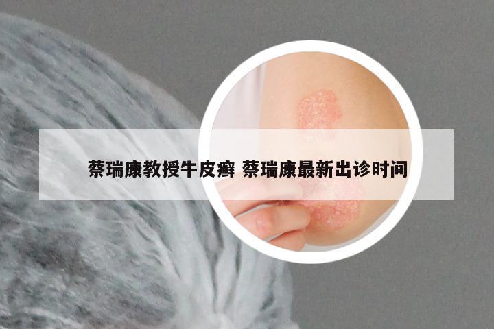 蔡瑞康教授牛皮癣 蔡瑞康最新出诊时间