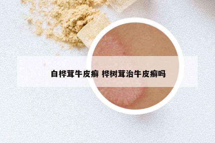 白桦茸牛皮癣 桦树茸治牛皮癣吗