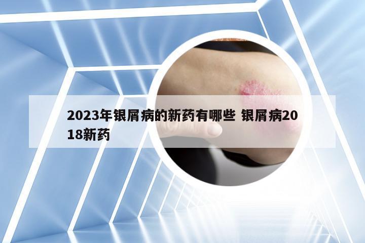 2023年银屑病的新药有哪些 银屑病2018新药
