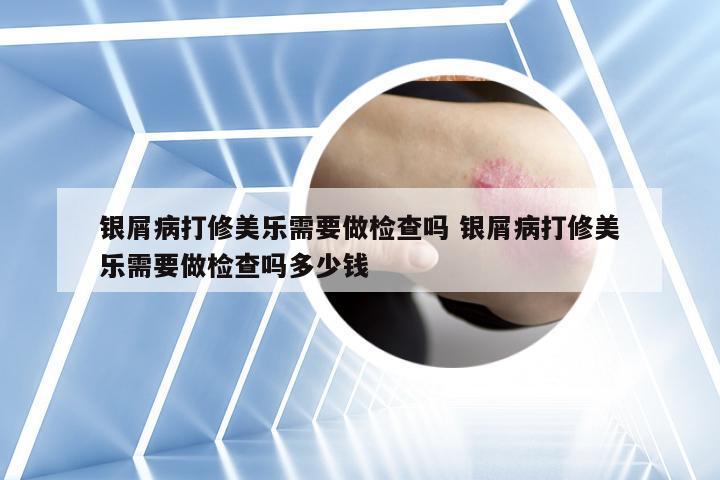 银屑病打修美乐需要做检查吗 银屑病打修美乐需要做检查吗多少钱