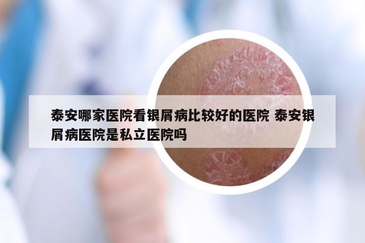 泰安哪家医院看银屑病比较好的医院 泰安银屑病医院是私立医院吗