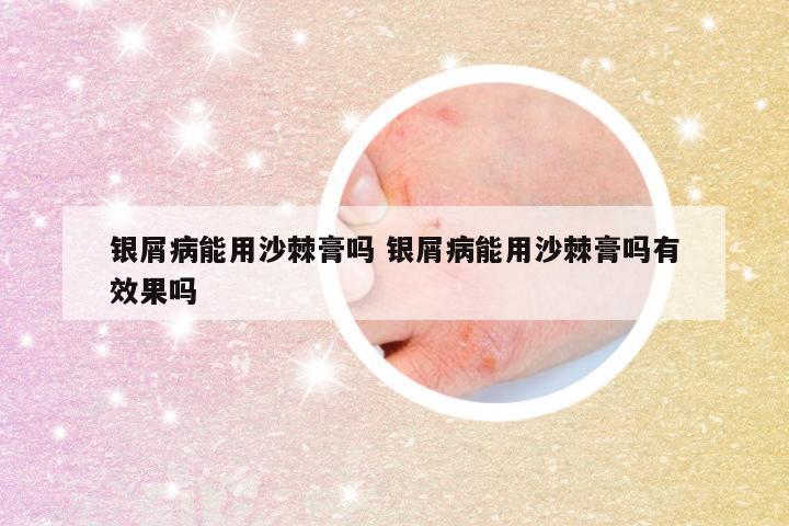 银屑病能用沙棘膏吗 银屑病能用沙棘膏吗有效果吗