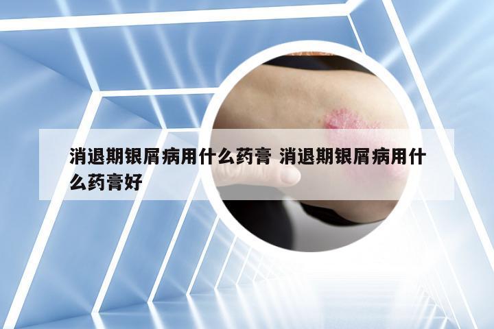 消退期银屑病用什么药膏 消退期银屑病用什么药膏好