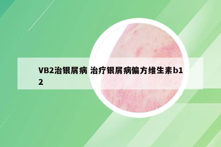 VB2治银屑病 治疗银屑病偏方维生素b12