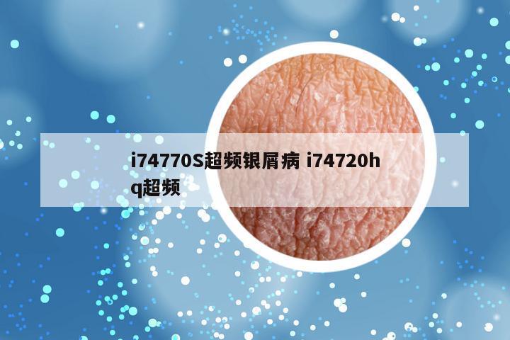 i74770S超频银屑病 i74720hq超频