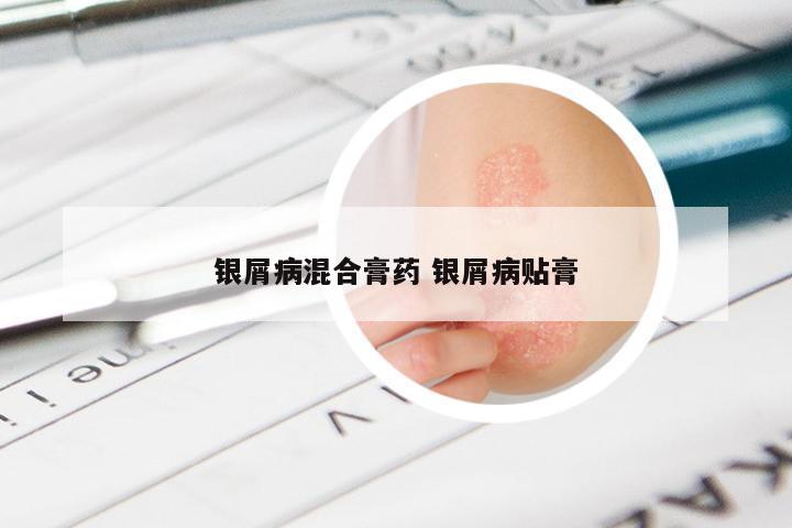 银屑病混合膏药 银屑病贴膏