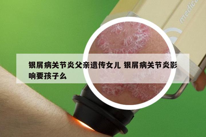 银屑病关节炎父亲遗传女儿 银屑病关节炎影响要孩子么