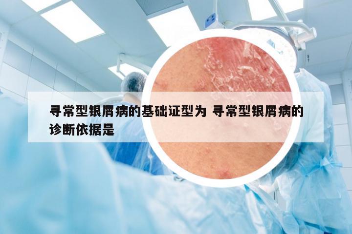 寻常型银屑病的基础证型为 寻常型银屑病的诊断依据是