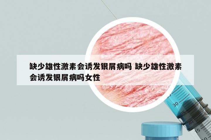 缺少雄性激素会诱发银屑病吗 缺少雄性激素会诱发银屑病吗女性