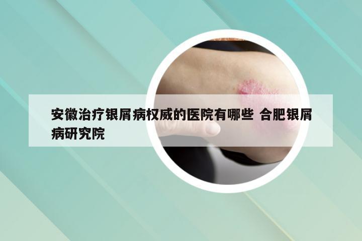 安徽治疗银屑病权威的医院有哪些 合肥银屑病研究院