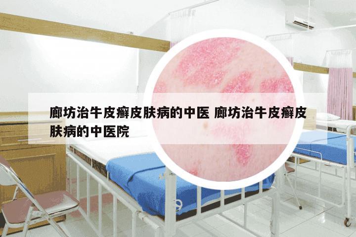 廊坊治牛皮癣皮肤病的中医 廊坊治牛皮癣皮肤病的中医院
