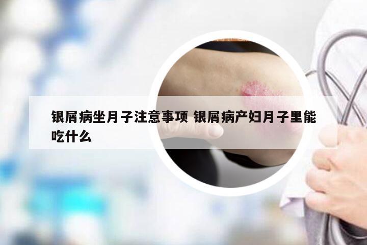 银屑病坐月子注意事项 银屑病产妇月子里能吃什么