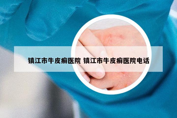 镇江市牛皮癣医院 镇江市牛皮癣医院电话