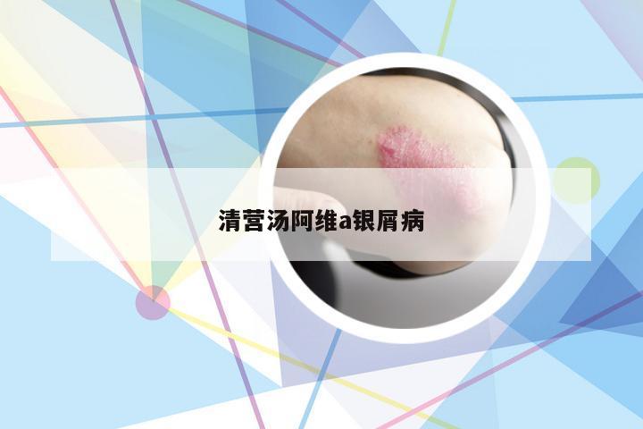 清营汤阿维a银屑病