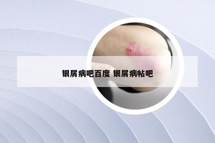 银屑病吧百度 银屑病帖吧