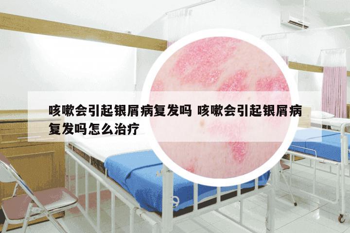 咳嗽会引起银屑病复发吗 咳嗽会引起银屑病复发吗怎么治疗