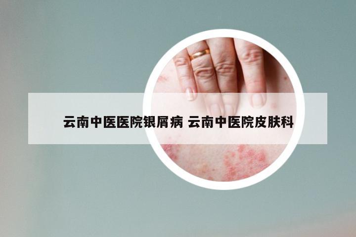 云南中医医院银屑病 云南中医院皮肤科