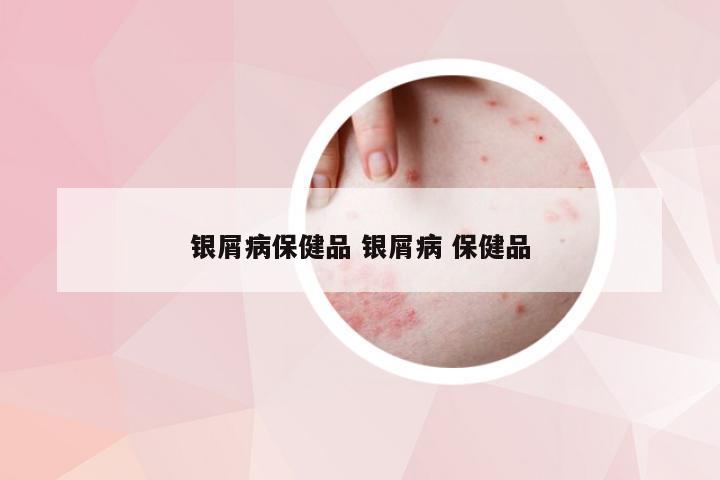 银屑病保健品 银屑病 保健品