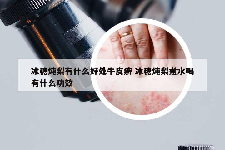 冰糖炖梨有什么好处牛皮癣 冰糖炖梨煮水喝有什么功效