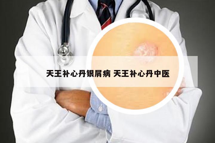 天王补心丹银屑病 天王补心丹中医