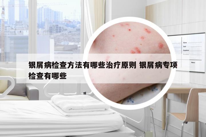 银屑病检查方法有哪些治疗原则 银屑病专项检查有哪些