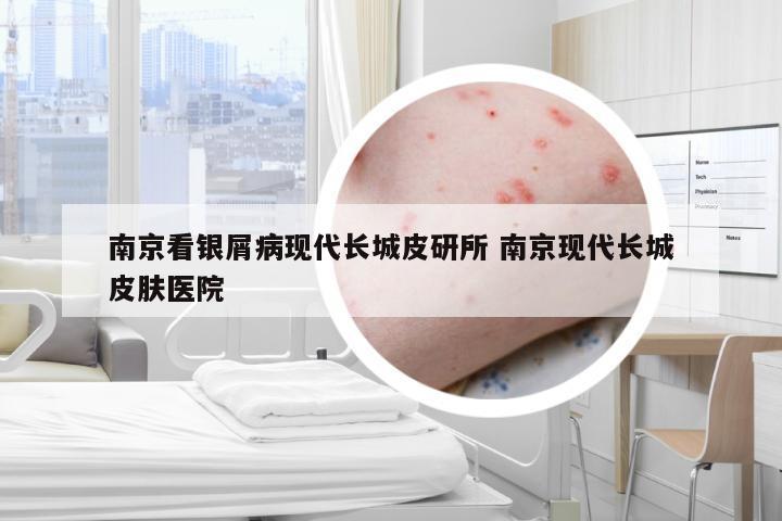 南京看银屑病现代长城皮研所 南京现代长城皮肤医院