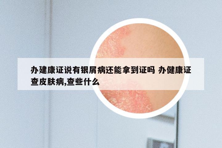 办建康证说有银屑病还能拿到证吗 办健康证查皮肤病,查些什么