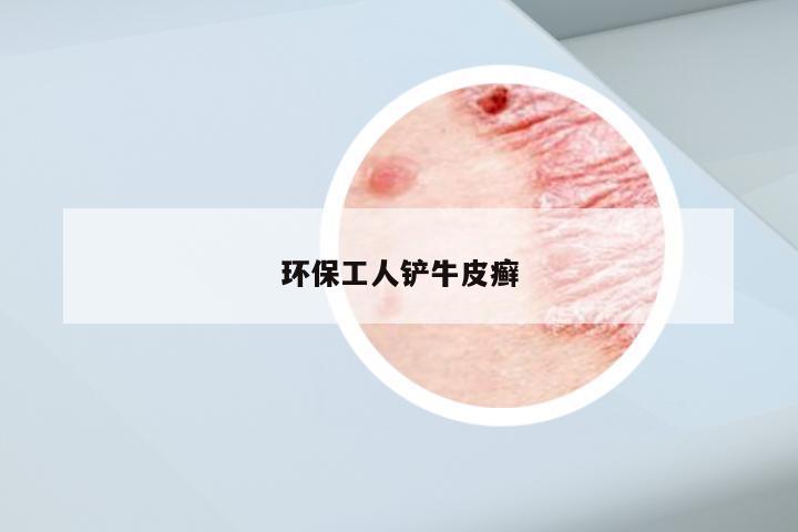 环保工人铲牛皮癣
