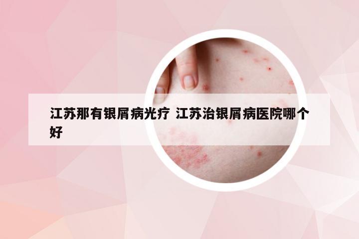 江苏那有银屑病光疗 江苏治银屑病医院哪个好