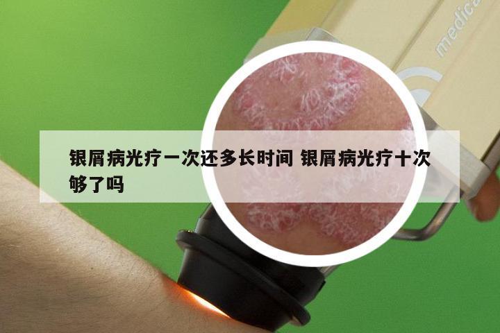 银屑病光疗一次还多长时间 银屑病光疗十次够了吗