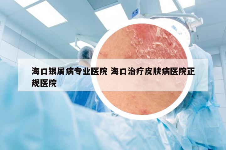 海口银屑病专业医院 海口治疗皮肤病医院正规医院