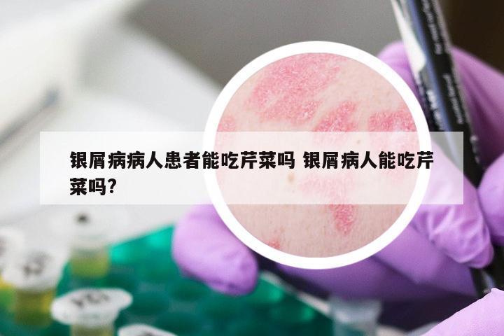 银屑病病人患者能吃芹菜吗 银屑病人能吃芹菜吗?