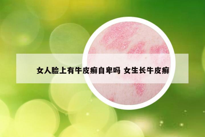 女人脸上有牛皮癣自卑吗 女生长牛皮癣