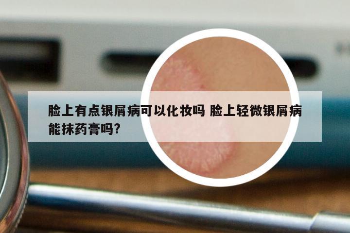 脸上有点银屑病可以化妆吗 脸上轻微银屑病能抹药膏吗?