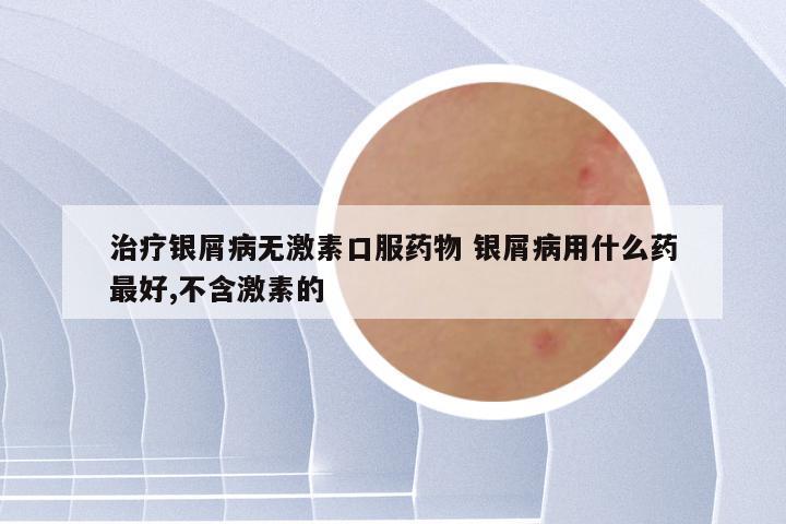 治疗银屑病无激素口服药物 银屑病用什么药最好,不含激素的