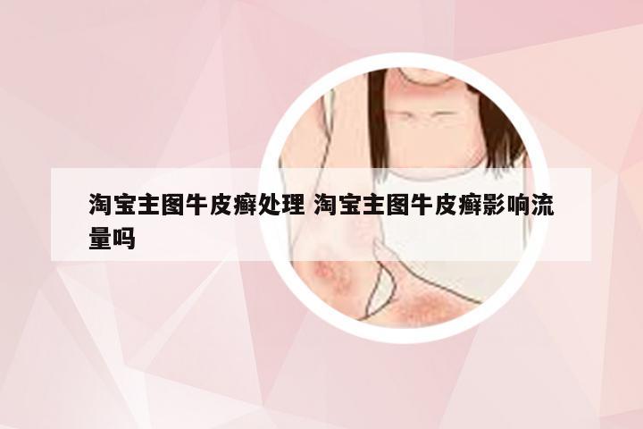 淘宝主图牛皮癣处理 淘宝主图牛皮癣影响流量吗