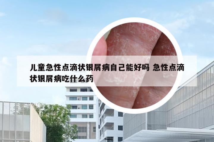 儿童急性点滴状银屑病自己能好吗 急性点滴状银屑病吃什么药