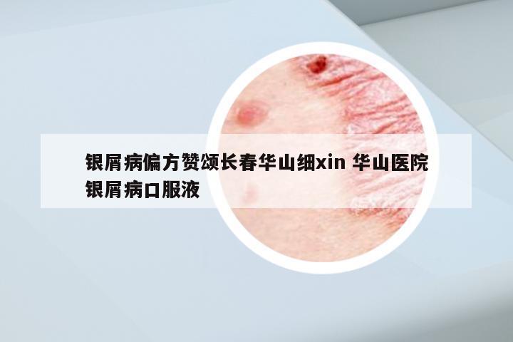银屑病偏方赞颂长春华山细xin 华山医院银屑病口服液