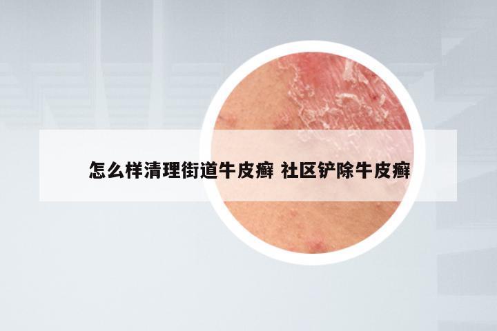 怎么样清理街道牛皮癣 社区铲除牛皮癣