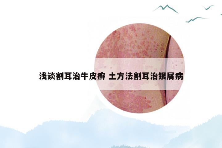 浅谈割耳治牛皮癣 土方法割耳治银屑病
