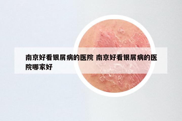 南京好看银屑病的医院 南京好看银屑病的医院哪家好