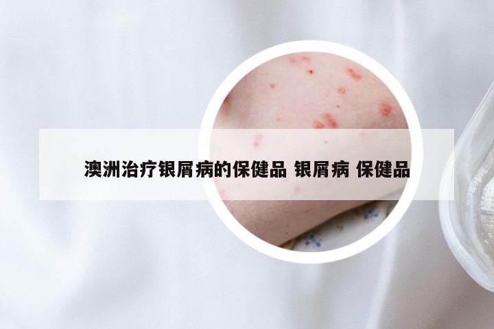 澳洲治疗银屑病的保健品 银屑病 保健品