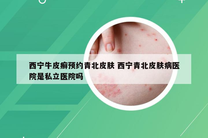 西宁牛皮癣预约青北皮肤 西宁青北皮肤病医院是私立医院吗
