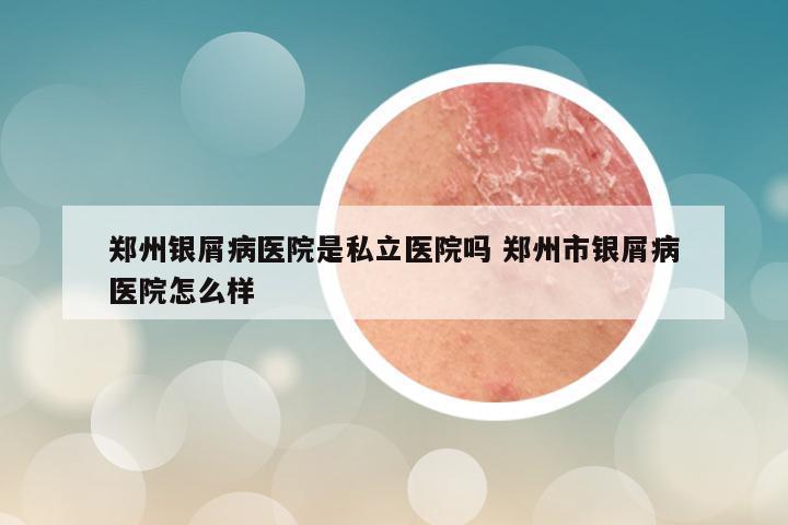 郑州银屑病医院是私立医院吗 郑州市银屑病医院怎么样