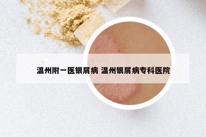 温州附一医银屑病 温州银屑病专科医院