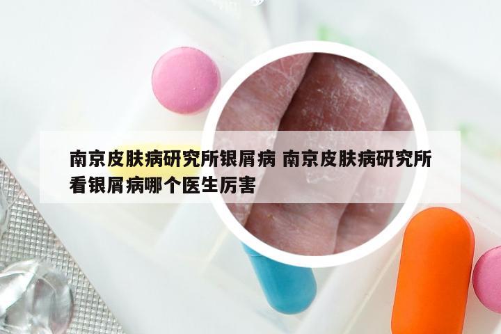 南京皮肤病研究所银屑病 南京皮肤病研究所看银屑病哪个医生厉害